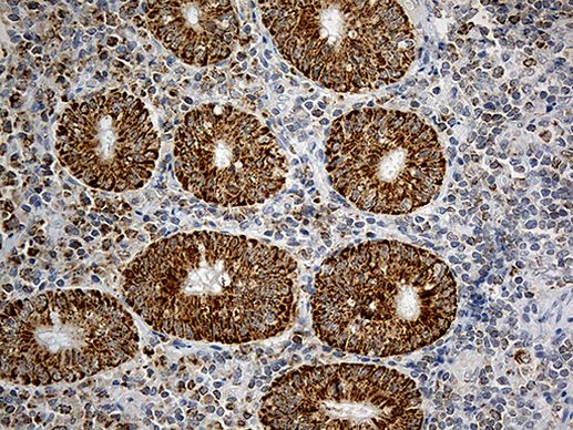 CHCHD10 Antibody in Immunohistochemistry (Paraffin) (IHC (P))