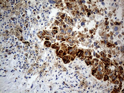 CHCHD10 Antibody in Immunohistochemistry (Paraffin) (IHC (P))