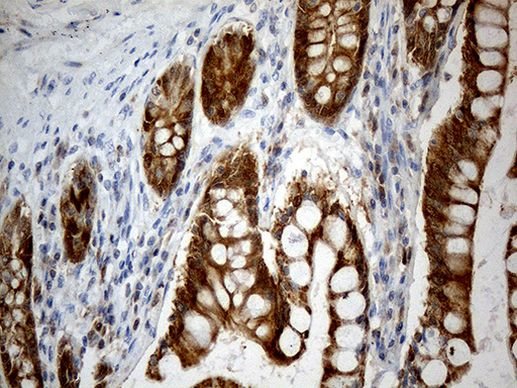 CHCHD10 Antibody in Immunohistochemistry (Paraffin) (IHC (P))