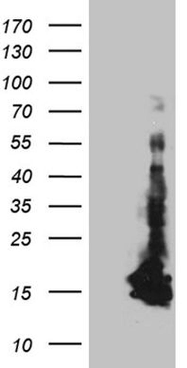 CHCHD10 Antibody in Western Blot (WB)