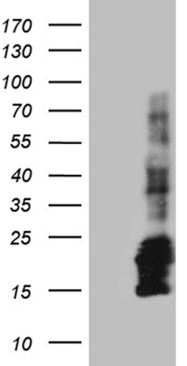 CHCHD10 Antibody in Western Blot (WB)