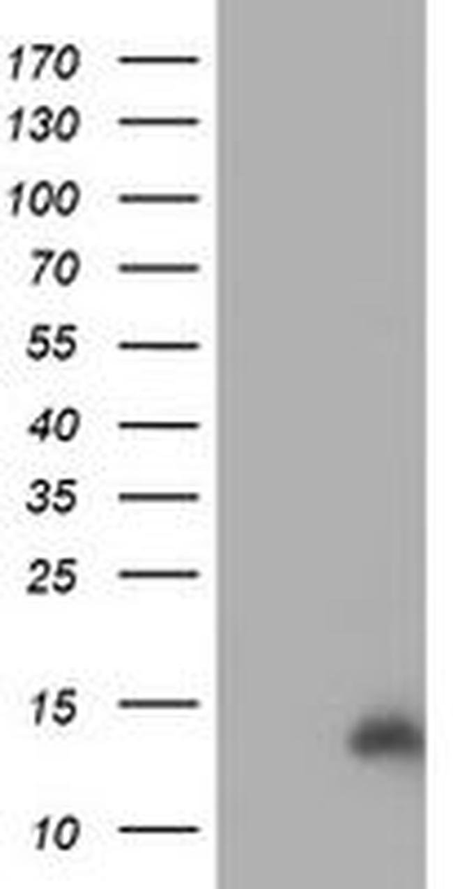 CHCHD5 Antibody in Western Blot (WB)