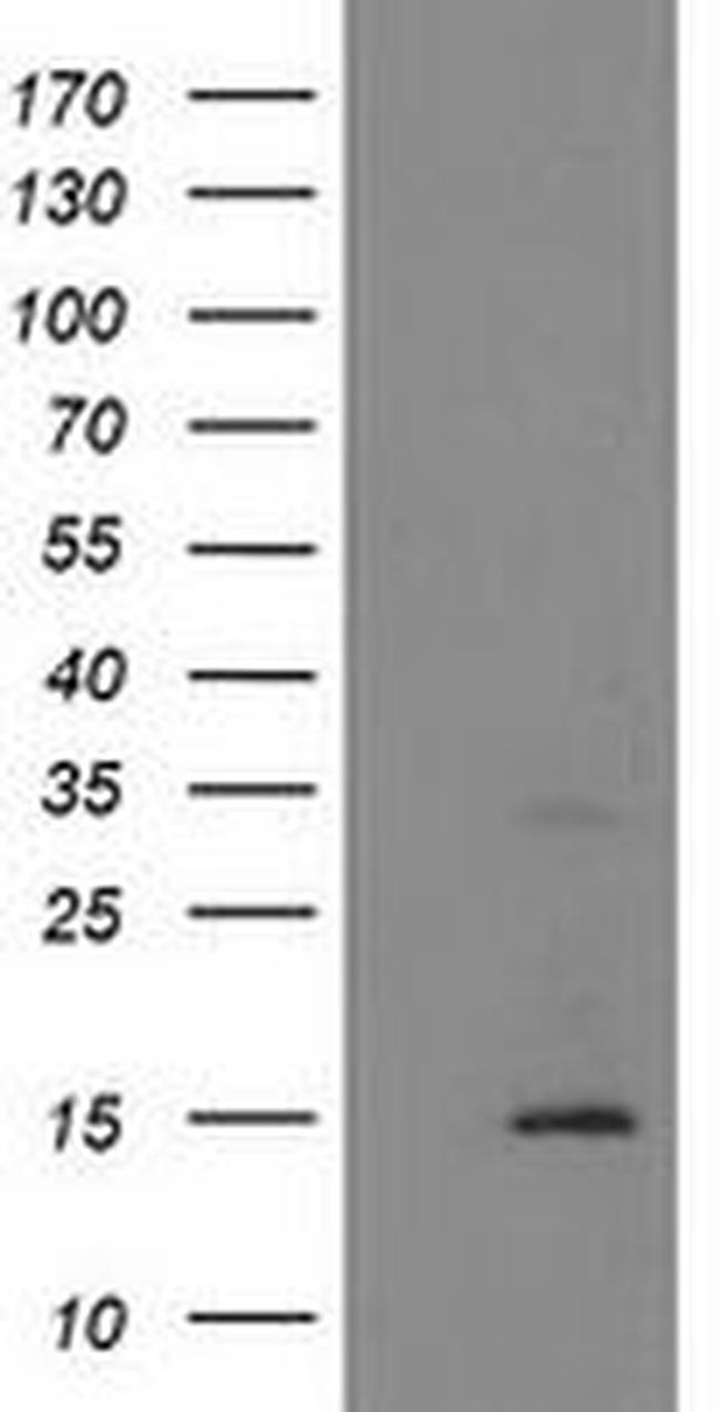 CHCHD5 Antibody in Western Blot (WB)