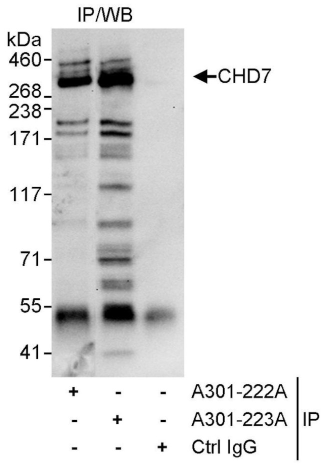 CHD7 Antibody in Immunoprecipitation (IP)