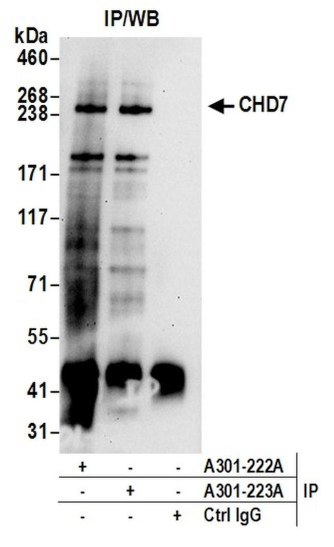 CHD7 Antibody in Immunoprecipitation (IP)