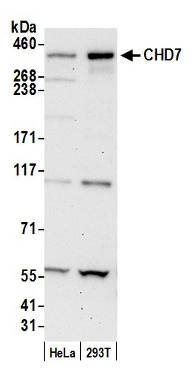 CHD7 Antibody in Western Blot (WB)