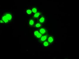 CHEK2 Antibody in Immunocytochemistry (ICC/IF)