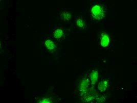 CHEK2 Antibody in Immunocytochemistry (ICC/IF)