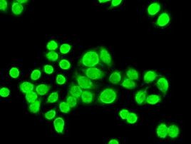 CHEK2 Antibody in Immunocytochemistry (ICC/IF)