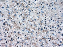 CHEK2 Antibody in Immunohistochemistry (Paraffin) (IHC (P))