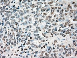 CHEK2 Antibody in Immunohistochemistry (Paraffin) (IHC (P))