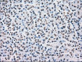 CHEK2 Antibody in Immunohistochemistry (Paraffin) (IHC (P))