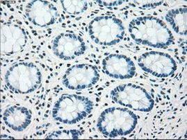 CHEK2 Antibody in Immunohistochemistry (Paraffin) (IHC (P))