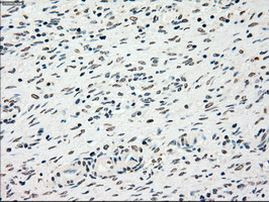 CHEK2 Antibody in Immunohistochemistry (Paraffin) (IHC (P))