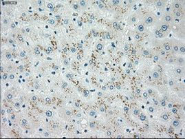 CHEK2 Antibody in Immunohistochemistry (Paraffin) (IHC (P))