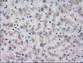 CHEK2 Antibody in Immunohistochemistry (Paraffin) (IHC (P))