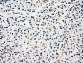 CHEK2 Antibody in Immunohistochemistry (Paraffin) (IHC (P))