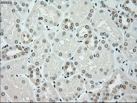 CHEK2 Antibody in Immunohistochemistry (Paraffin) (IHC (P))