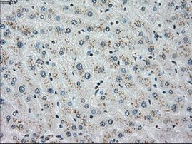 CHEK2 Antibody in Immunohistochemistry (Paraffin) (IHC (P))