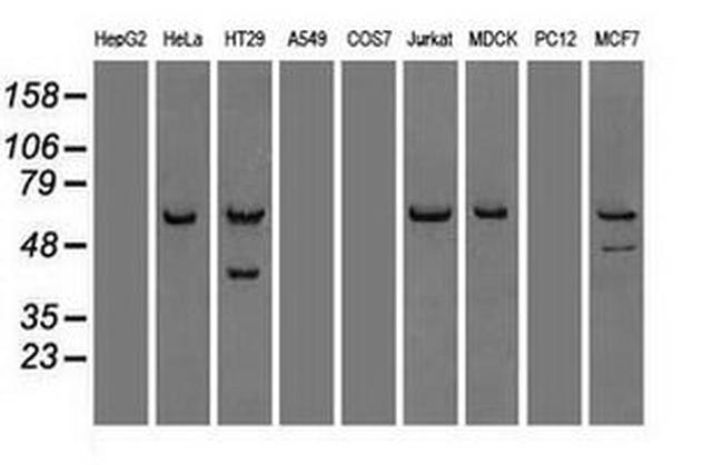 CHEK2 Antibody in Western Blot (WB)