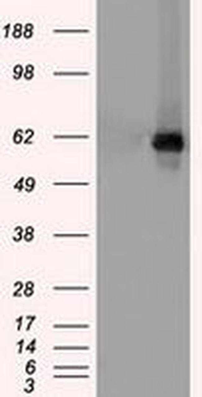 CHEK2 Antibody in Western Blot (WB)