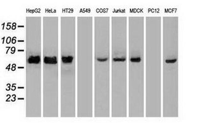 CHEK2 Antibody in Western Blot (WB)