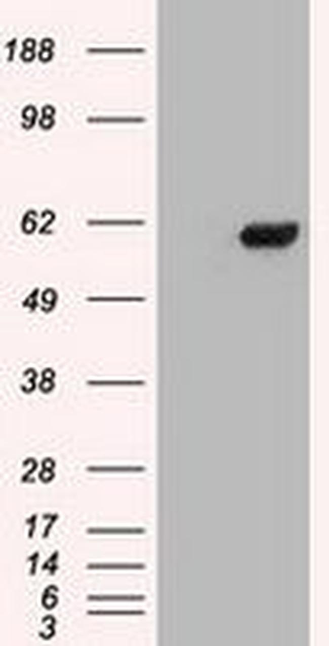 CHEK2 Antibody in Western Blot (WB)