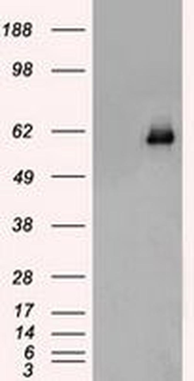 CHEK2 Antibody in Western Blot (WB)