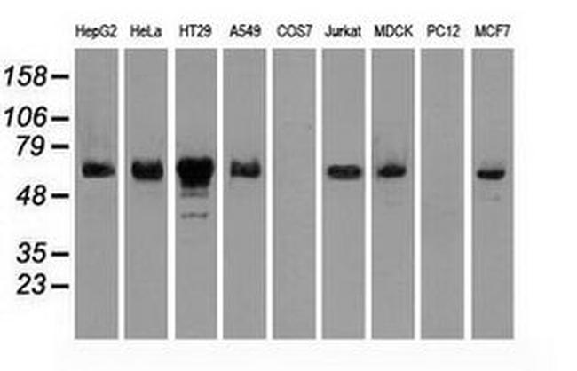 CHEK2 Antibody in Western Blot (WB)