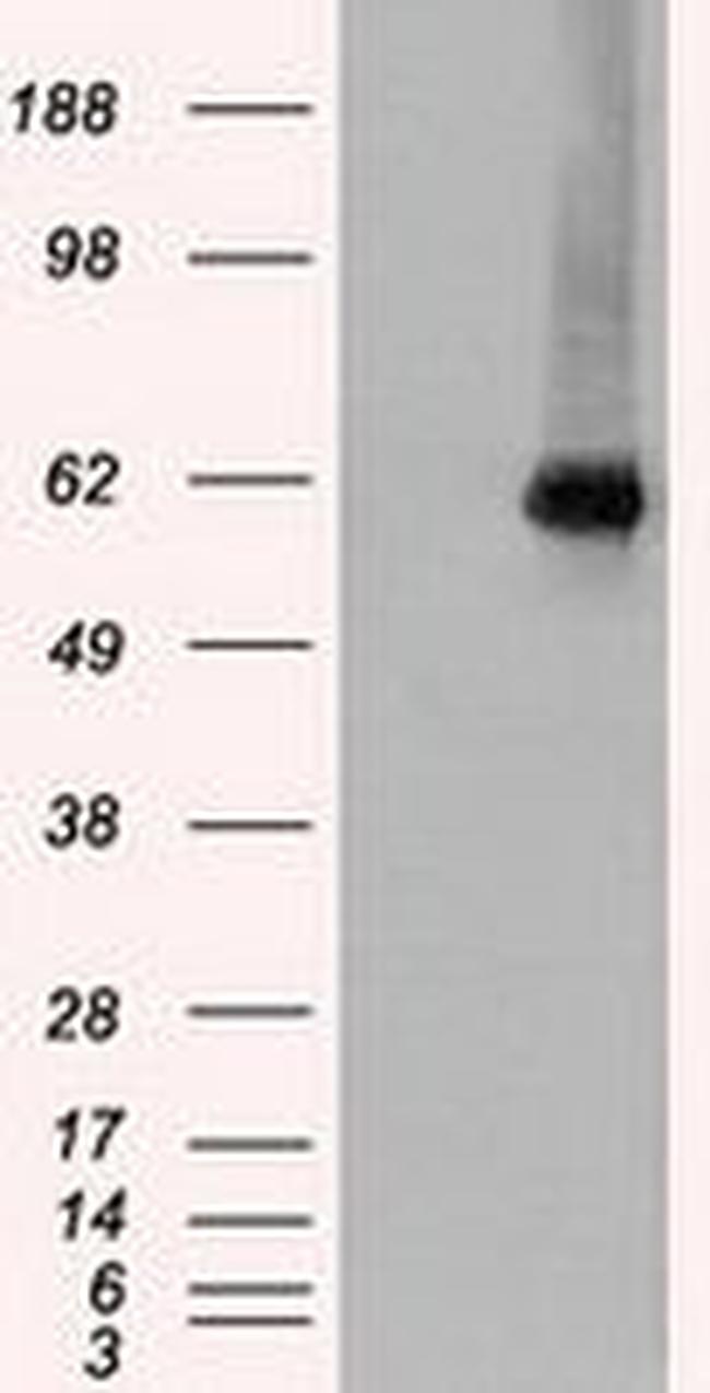 CHEK2 Antibody in Western Blot (WB)