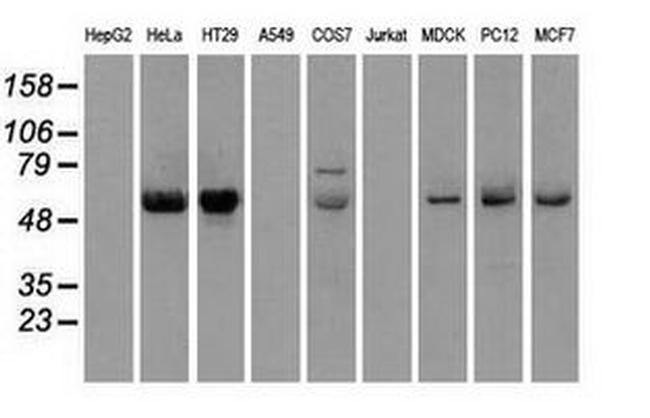 CHEK2 Antibody in Western Blot (WB)