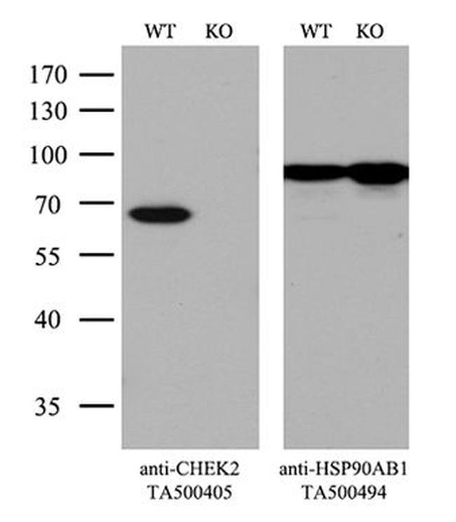 CHEK2 Antibody in Western Blot (WB)