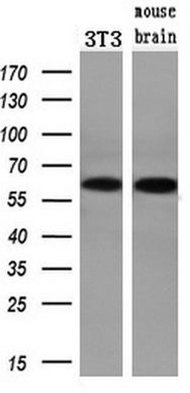 CHEK2 Antibody in Western Blot (WB)