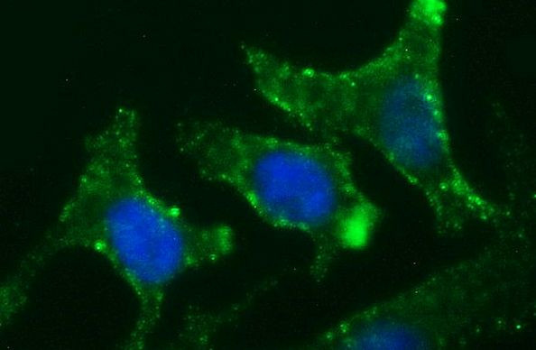 CHGA Antibody in Immunocytochemistry (ICC/IF)