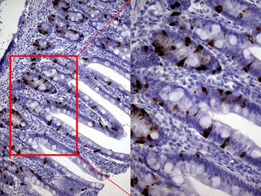 CHGA Antibody in Immunohistochemistry (Paraffin) (IHC (P))