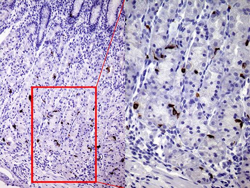 CHGA Antibody in Immunohistochemistry (Paraffin) (IHC (P))