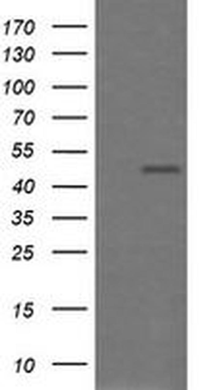 CHGA Antibody in Western Blot (WB)