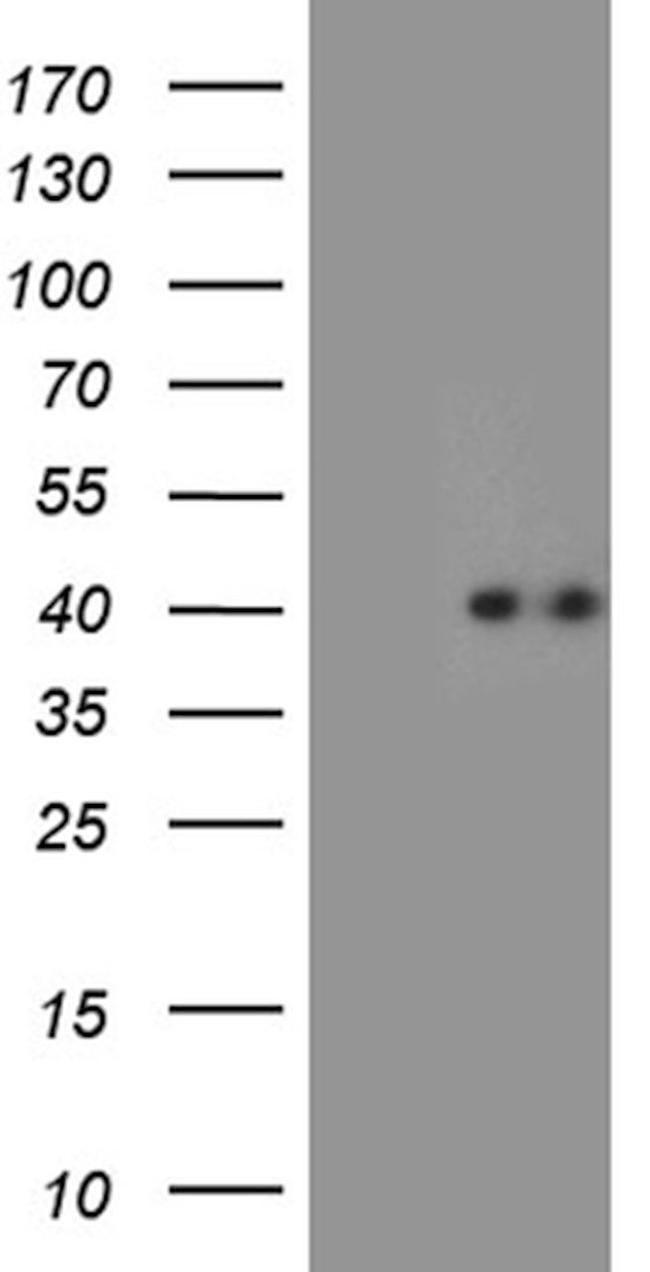 CHIA Antibody in Western Blot (WB)