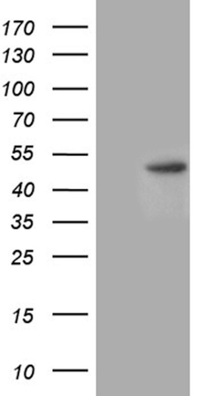 CHIA Antibody in Western Blot (WB)