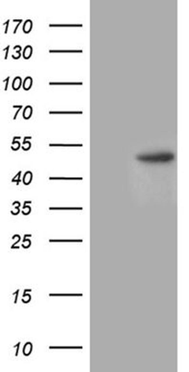 CHIA Antibody in Western Blot (WB)