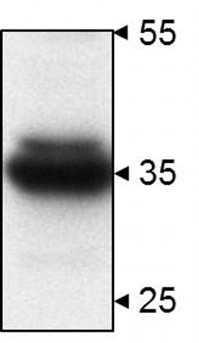 STUB1 Antibody in Western Blot (WB)