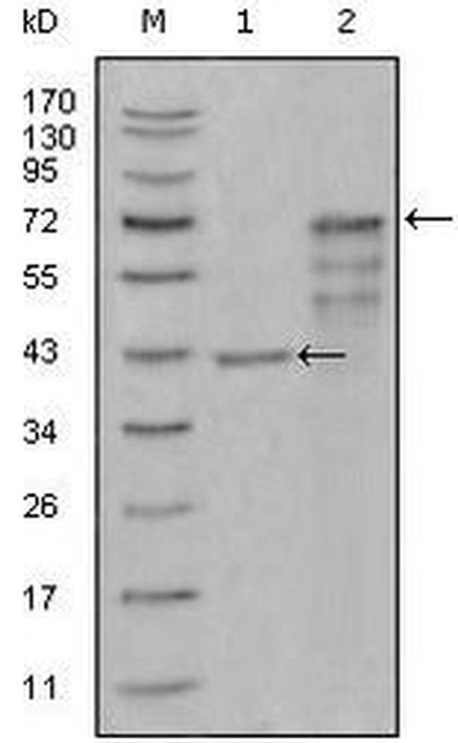 Chitotriosidase Antibody in Western Blot (WB)