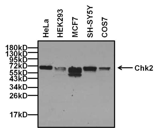 CHK2 Antibody in Western Blot (WB)