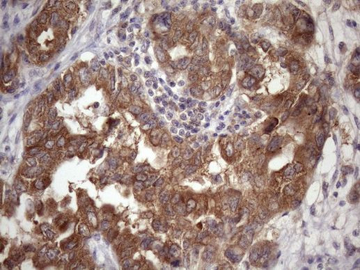 CHMP5 Antibody in Immunohistochemistry (Paraffin) (IHC (P))