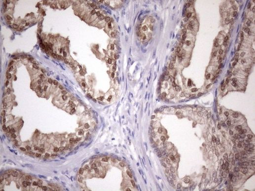 CHMP5 Antibody in Immunohistochemistry (Paraffin) (IHC (P))