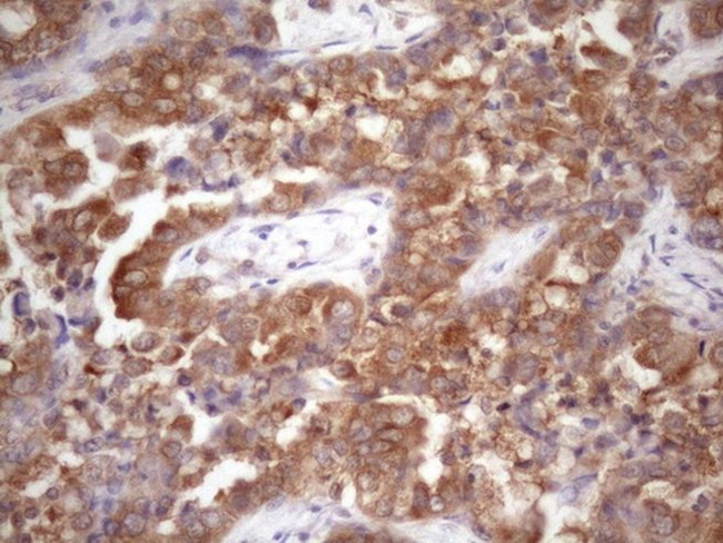 CHMP5 Antibody in Immunohistochemistry (Paraffin) (IHC (P))