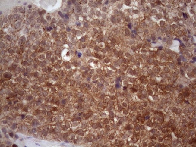 CHMP5 Antibody in Immunohistochemistry (Paraffin) (IHC (P))