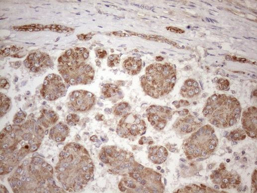 CHMP5 Antibody in Immunohistochemistry (Paraffin) (IHC (P))