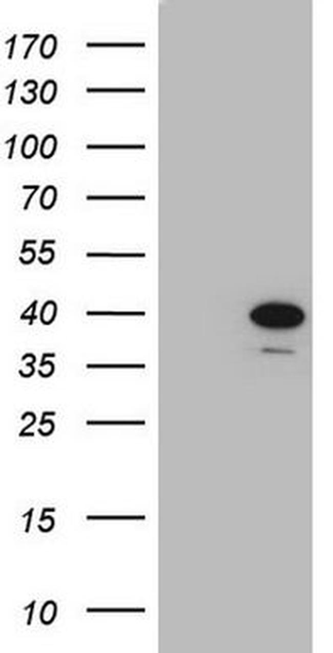 CHMP5 Antibody in Western Blot (WB)