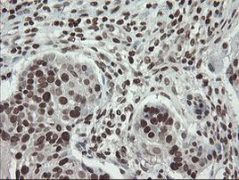 CHN1 Antibody in Immunohistochemistry (Paraffin) (IHC (P))